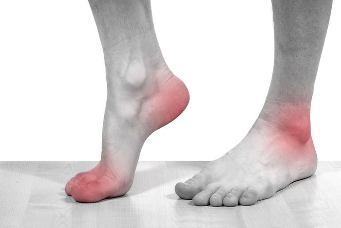 Bệnh gout có tác động lớn đến khả năng di chuyển