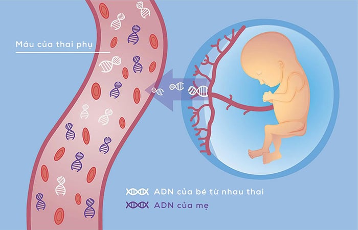 Xét nghiệm NIPT hỗ trợ sàng lọc sớm hội chứng DiGeorge