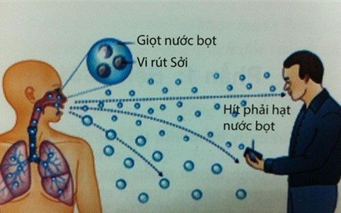 chăm sóc khi trẻ mắc bệnh sởi