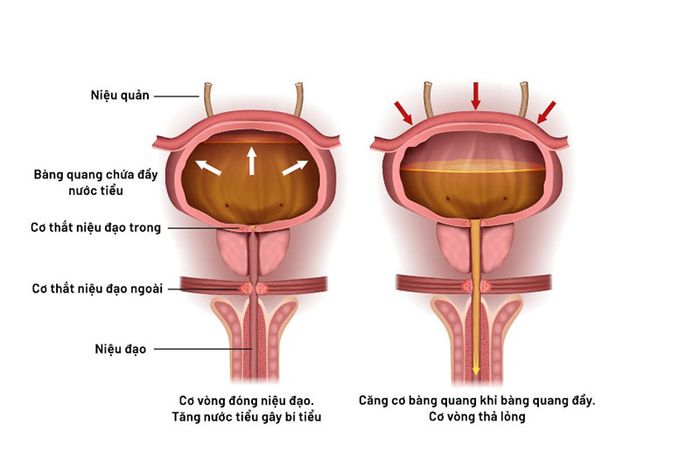 Niệu Quản - Một Phần Quan Trọng Của Hệ Tiết Niệu