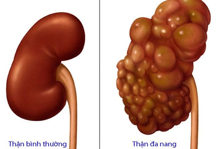 Bệnh có thể dẫn đến các biến chứng nghiêm trọng