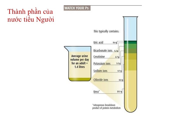 Nước tiểu có mùi lạ có thể là dấu hiệu của bệnh phenylceton niệu.