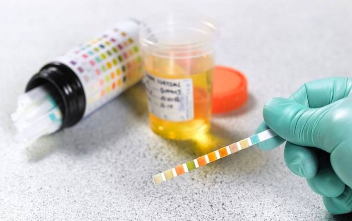 Sẽ tiến hành các xét nghiệm và kiểm tra