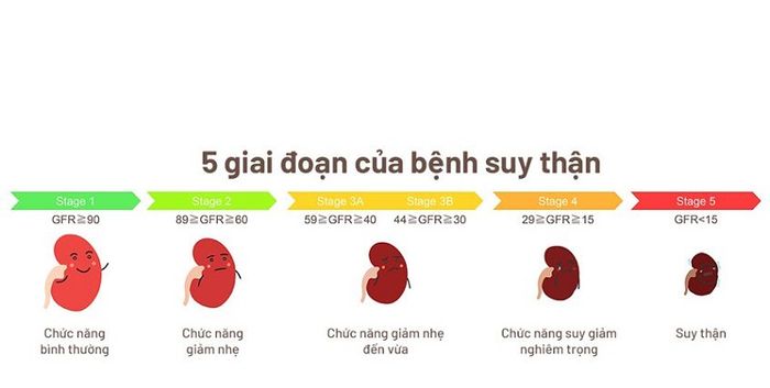 Bệnh suy thận được chia thành 5 cấp độ, suy thận độ 2 là giai đoạn bắt đầu của tình trạng này