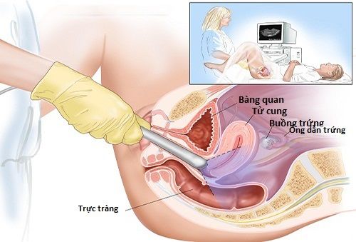 Siêu âm đầu dò tại MEDLATEC đảm bảo an toàn, nhanh chóng và chính xác