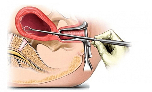 Siêu âm đầu dò tại MEDLATEC đảm bảo an toàn, nhanh chóng và chính xác.