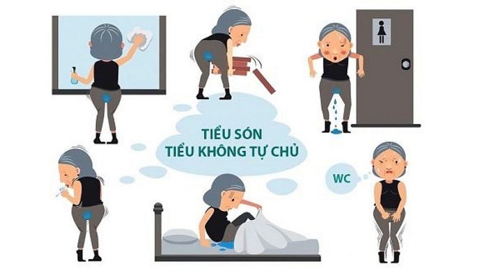 Triệu chứng phổ biến của bệnh rối loạn co thắt cơ trơn bàng quang