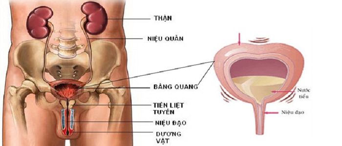 Sự rối loạn của cơ quan bàng quang