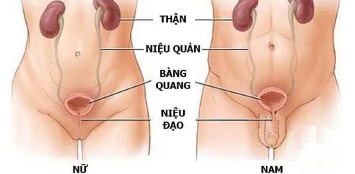 Nguyên nhân gây ra sỏi tiết niệu