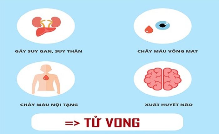 Biến chứng nguy hiểm của Sốt xuất huyết