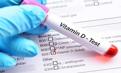 Xét nghiệm nồng độ vitamin D