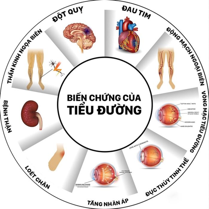 bệnh tiểu đường 