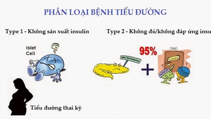 bệnh tiểu đường 