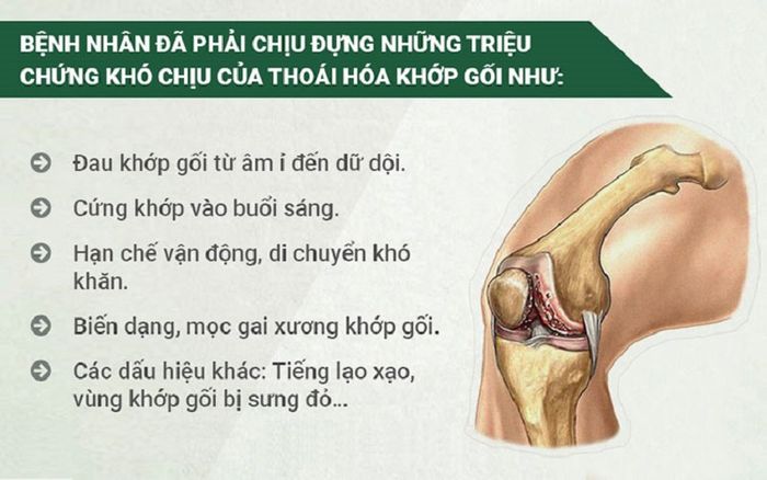 Dấu hiệu của thoái hóa khớp gối