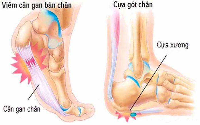 Những nguyên nhân nào có thể gây ra bệnh?