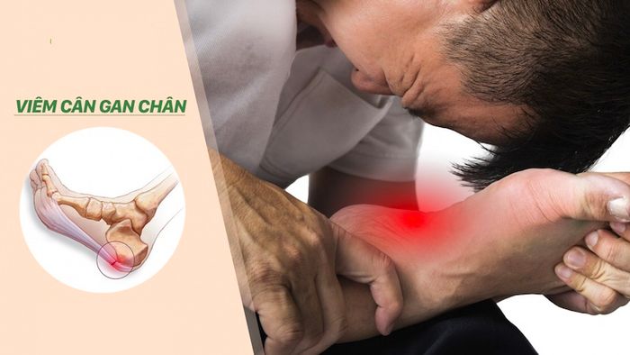 Những ai dễ mắc bệnh?