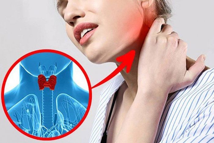 Phụ nữ dễ mắc các bệnh tuyến giáp hơn so với nam giới