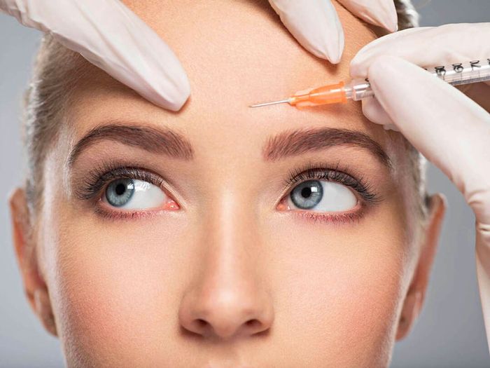 Tác dụng của botox là gì: Giúp giảm vết nhăn hiệu quả