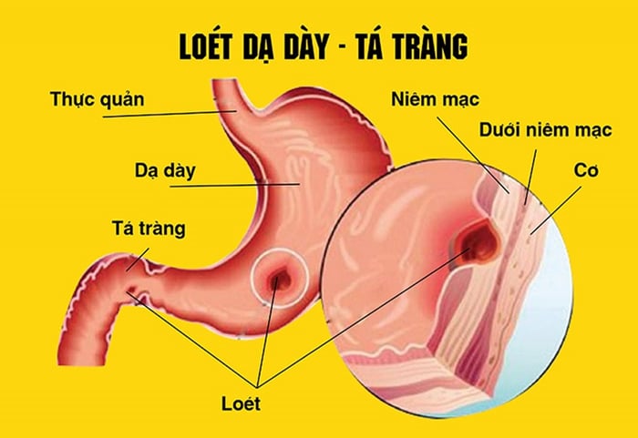 Không nên sử dụng sắn dây khi bị vấn đề về tiêu hóa.