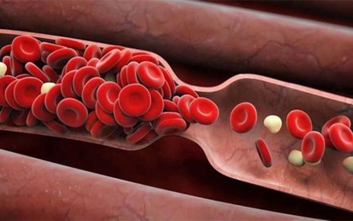 Khí huyết không luân chuyển là một trong những nguyên nhân khiến bàn chân bị lạnh