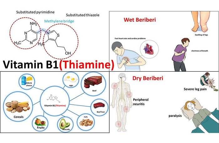 Thiếu vitamin B1 ảnh hưởng đến hệ thần kinh, gây ra các dấu hiệu như mệt mỏi, chán ăn, giảm nhận thức.