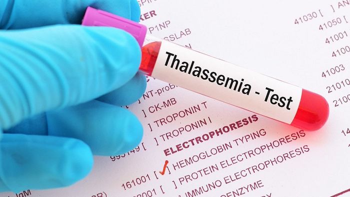 Thalassemia có thể dẫn đến thiếu máu nhược sắc