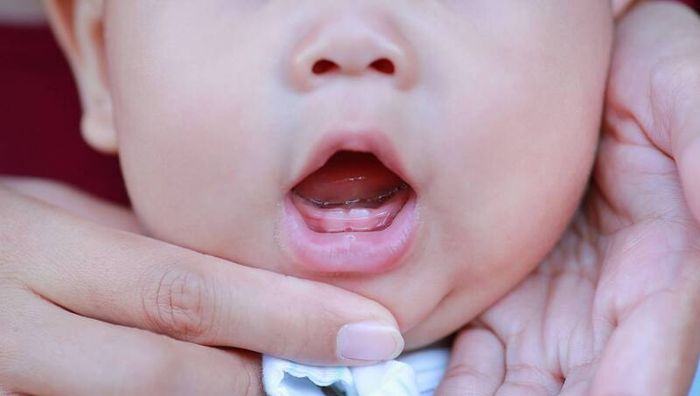 Tùy theo từng trường hợp, có thể cần phải loại bỏ hoặc giữ lại răng sơ sinh.