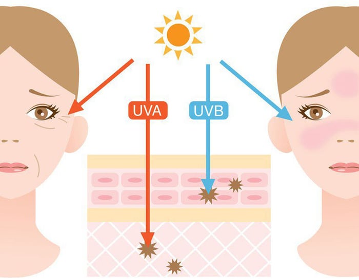 Tổng quan về các dạng tia UV