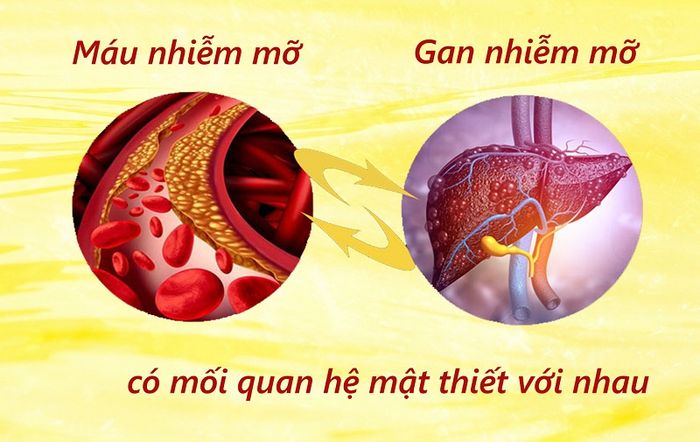 Nguy cơ của rối loạn lipid máu dẫn đến gan nhiễm mỡ