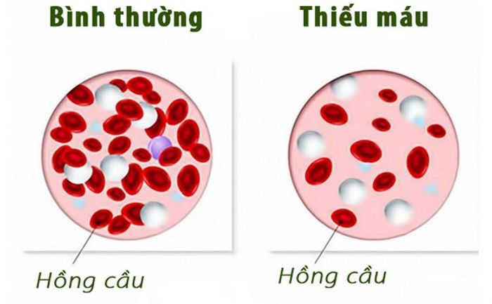 Cảm giác mệt mỏi là một vấn đề phổ biến, tuy nhiên, không phải ai cũng biết nguyên nhân gây ra nó.