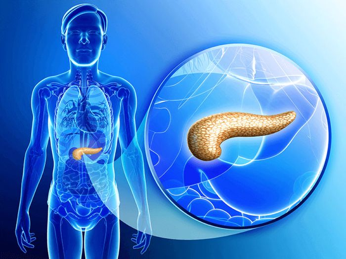 Viêm tụy cấp hoại tử là tình trạng rất nguy hiểm