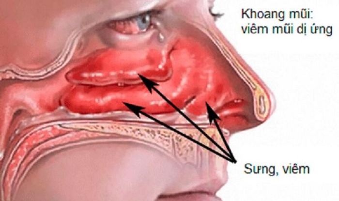 Cảnh báo về bệnh khi thường xuyên mất ngủ