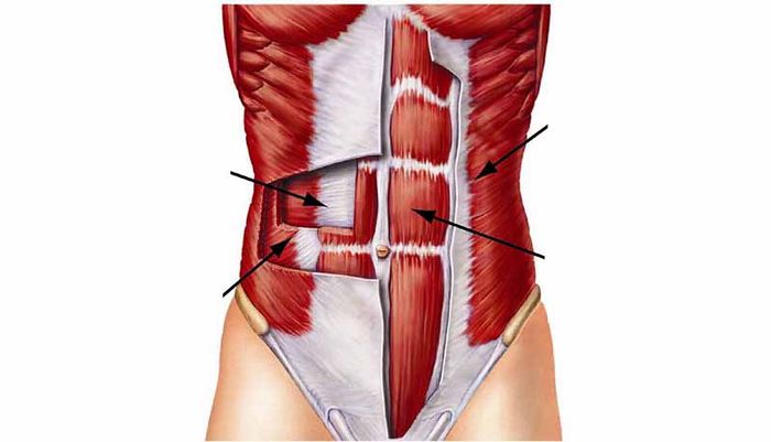 Hội chứng bao gồm các khuyết điểm bẩm sinh khiến cơ bụng teo hoặc biến mất