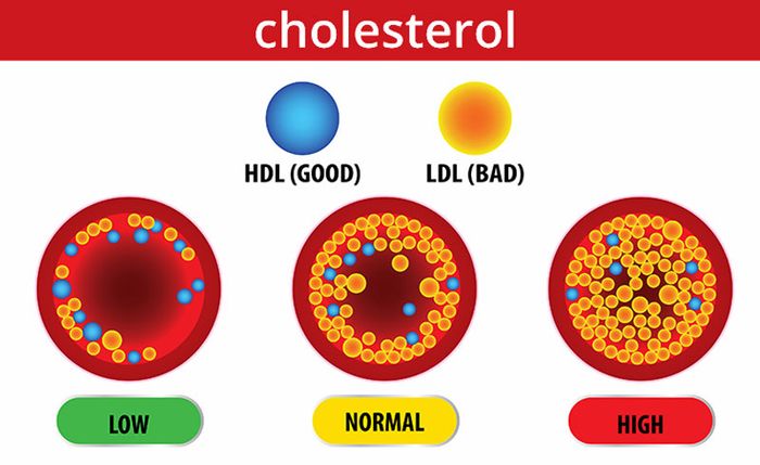 Cholesterol máu tăng cao có thể do yếu tố di truyền