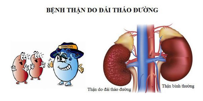 Bệnh tiểu đường có thể gây ra nhiều biến chứng nguy hiểm.