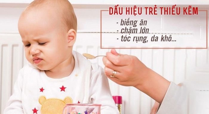 Dấu hiệu cảnh báo cho biết trẻ bị thiếu kẽm