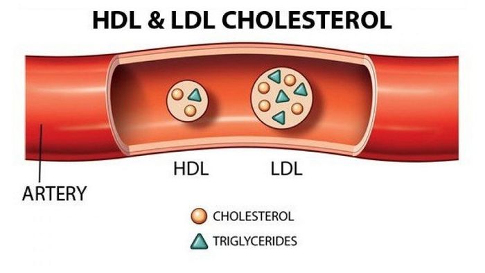 sự cố về lipid trong máu