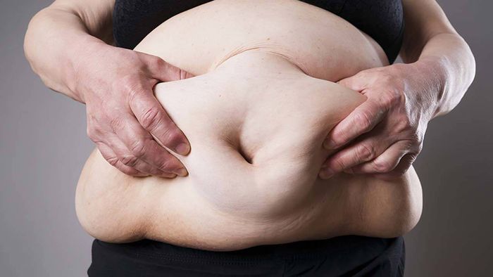 Nguyên tắc quan trọng nhất để giảm cân là giảm lượng mỡ thừa chứ không phải giảm nước