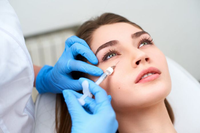 Tiêm filler có thể giúp giảm quầng thâm mắt nhanh chóng