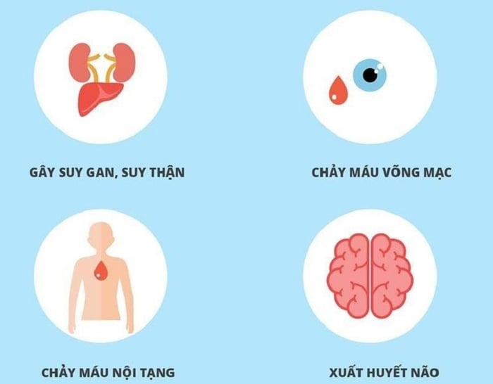 Tâm lý lo lắng về việc có vắc xin phòng sốt xuất huyết không chủ yếu bắt nguồn từ những biến chứng nguy hiểm của căn bệnh