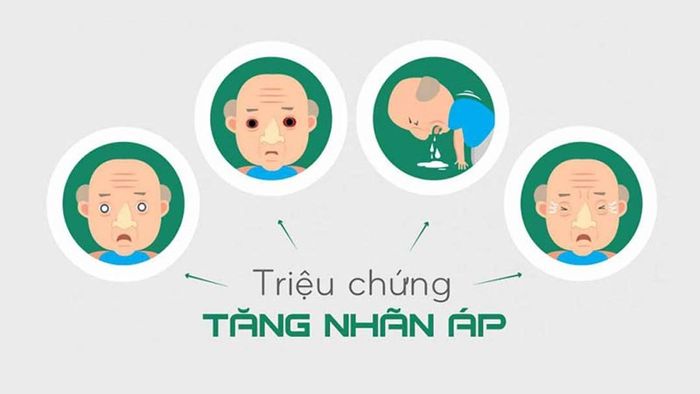 Dấu hiệu khi bị tăng áp nhãn