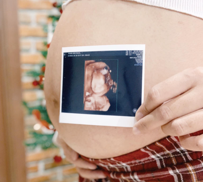 Vô sinh có phải là do di truyền không?
