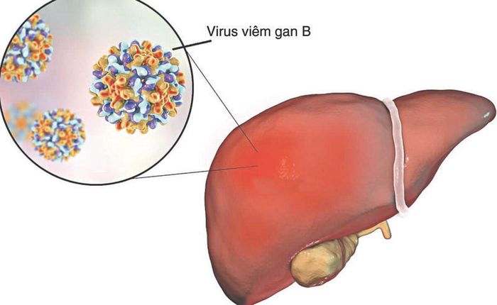 Trước khi kết hôn, nên tiêm vắc xin để phòng tránh virus viêm gan B và ngăn ngừa các biến chứng nguy hiểm