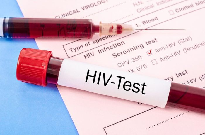 Để kiểm tra xem vi khuẩn HIV có lây nhiễm qua nuốt tinh trùng hay không, bạn cần thực hiện xét nghiệm HIV sau khi tiếp xúc 2 - 3 tháng.