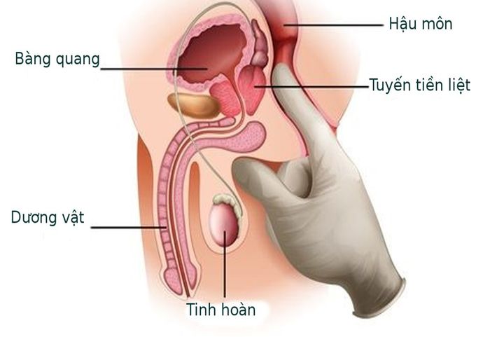 Điều quan trọng là biết rằng điểm G của nam giới có thể nằm ở tuyến tiền liệt