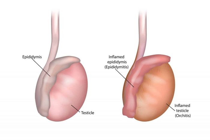 Tinh hoàn chịu trách nhiệm sản xuất tinh trùng và hormone testosterone