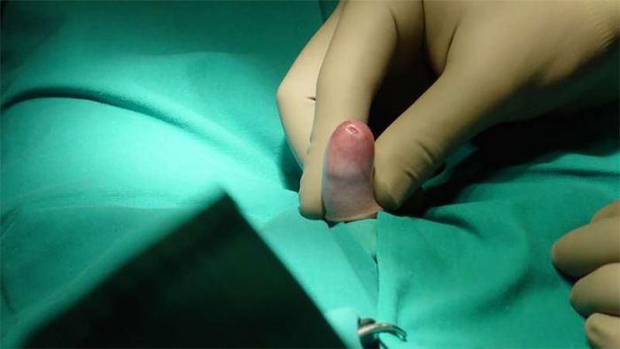 Nếu được phát hiện và điều trị kịp thời, tình trạng này có thể được giải quyết hoàn toàn