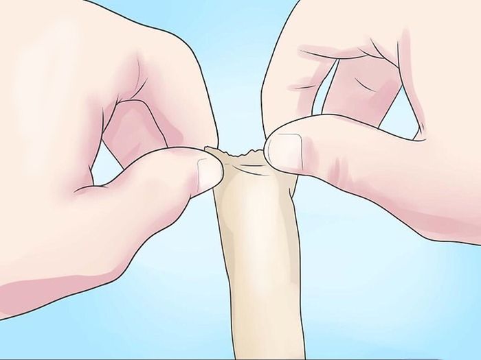 Bao nhiêu tuổi thì nên tiến hành lột bao quy đầu