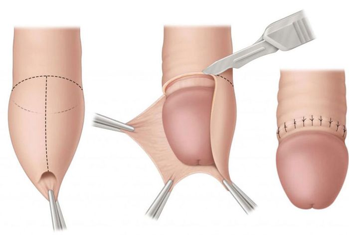Hiện nay, có nhiều phương pháp điều trị bệnh được áp dụng