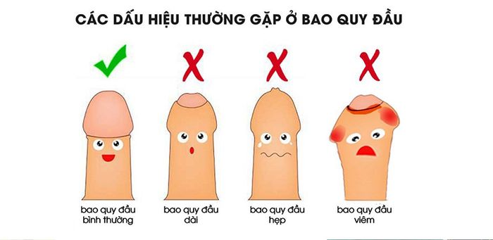 Một số tình trạng không bình thường của dương vật mà nam giới thường gặp